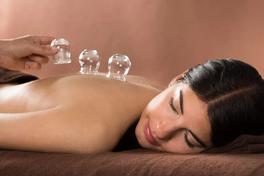 Cupping therapy cups on the back during a massage